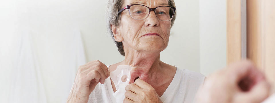 Atos Medical – Frau mit einem Tracheostoma reinigt die Haut um das Stoma
